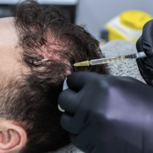 Advanced PRP Therapy
