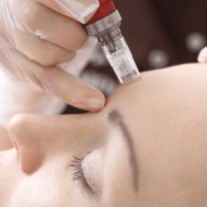 Level 4 Certificate in Skin Needling